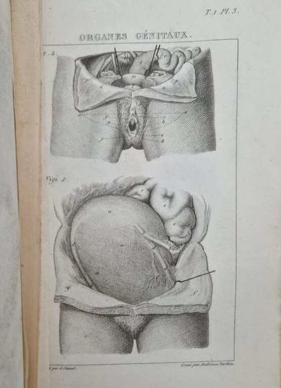 VELPEAU, Alfred-Armand-Louis-Marie. Traité...