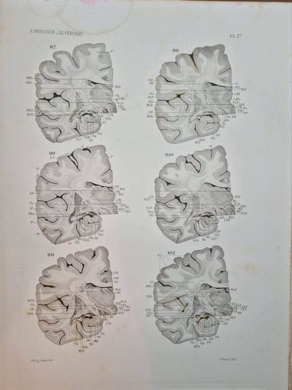 BRISSAUD, Edouard. Anatomie du Cerveau de...