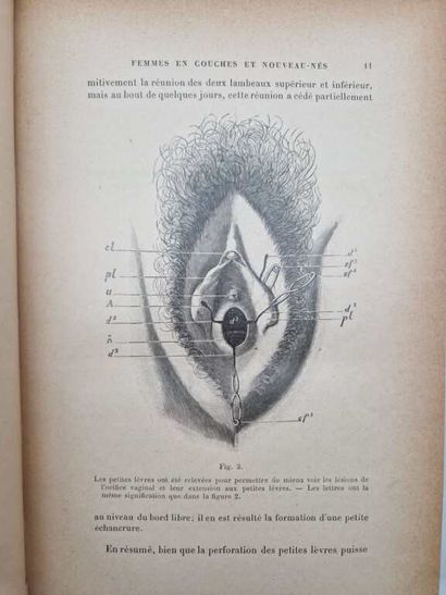 BUDIN, Pierre. Femmes en Couches et Nouveaux-Nés:...