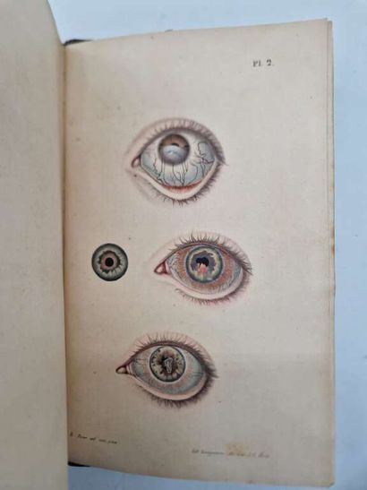 SICHEL, Jules. Traité de l'Ophthalmie, la...