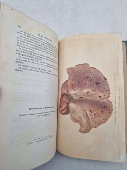 TARDIEU, Ambroise. Etude Médico-Légale sur...