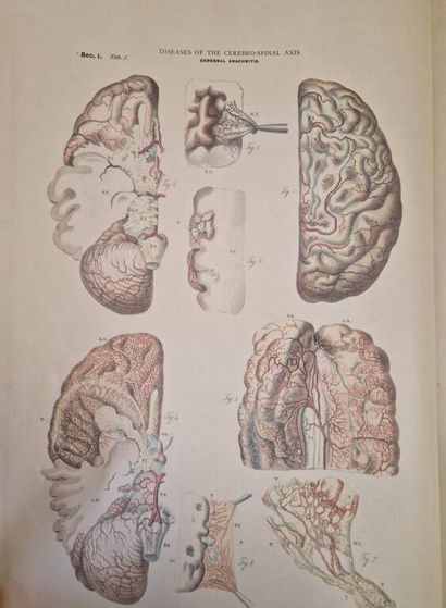 JEANCON, Jean. Pathological Anatomy, Pathology...