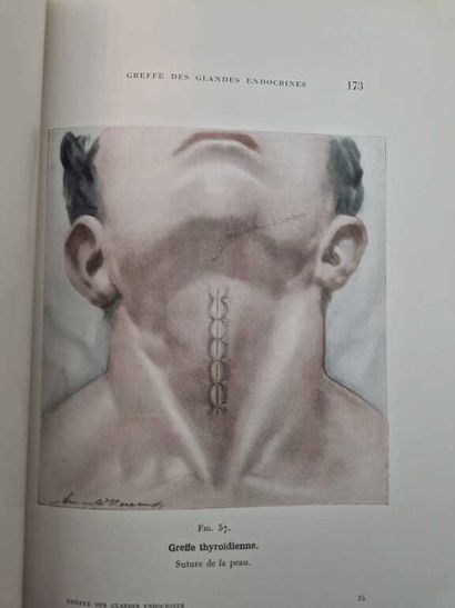 VORONOFF, Serge. Endoctrine Gland Transplantation....