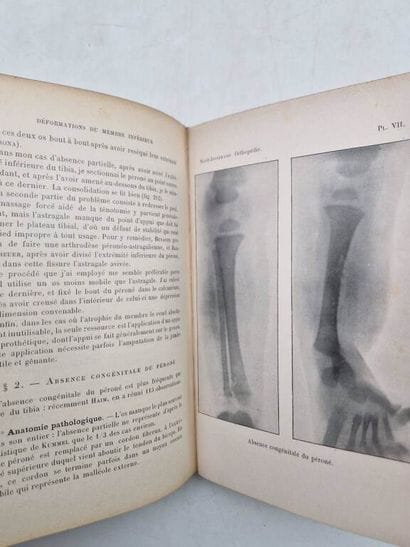 NOVE-JOSSERAND, Gabriel. Précis d'Orthopédie,...