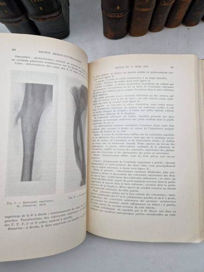 [PSYCHIATRY]. Annales Médico-Psychologiques....