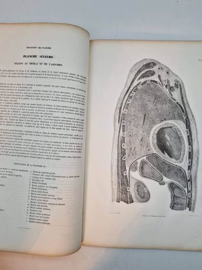 LE GENDRE, Eugène Quintien. Anatomie Chirurgicale...