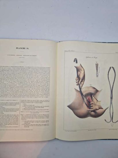 MOREAU, François-Joseph. Traité Pratique...