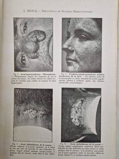 BROCQ, Louis. Précis-Atlas de Pratique Dermatologique....