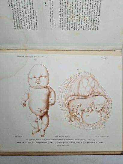 MARTIN-SAINT-ANGE, Gaspar Joseph. Iconographie...