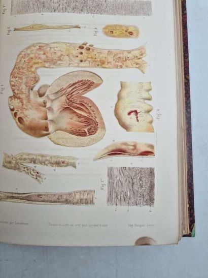 LANCEREAUX, Etienne and LACKERBAUER. Atlas...