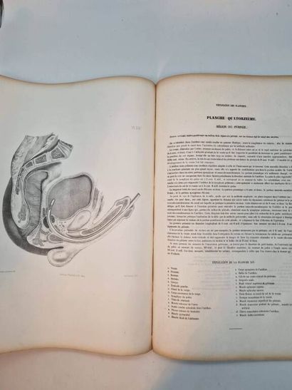 LE GENDRE, Eugène Quintien. Anatomie Chirurgicale...