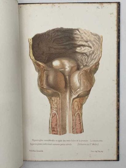 BEAU, Emile. Atlas of 14 color plates, published...