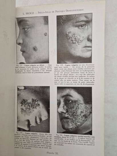 BROCQ, Louis. Précis-Atlas de Pratique Dermatologique....