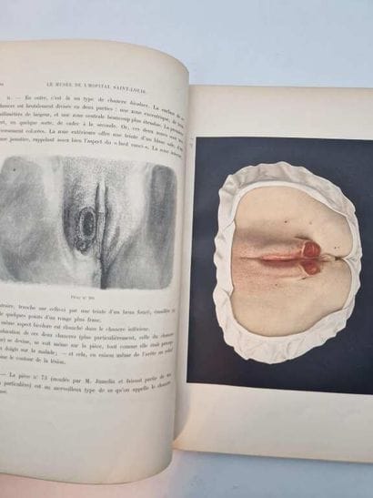 [ATLAS]. Le Musée de l'Hôpital Saint-Louis....