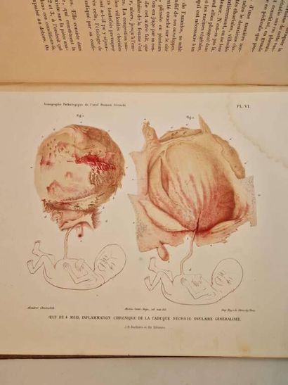 MARTIN-SAINT-ANGE, Gaspar Joseph. Iconographie...