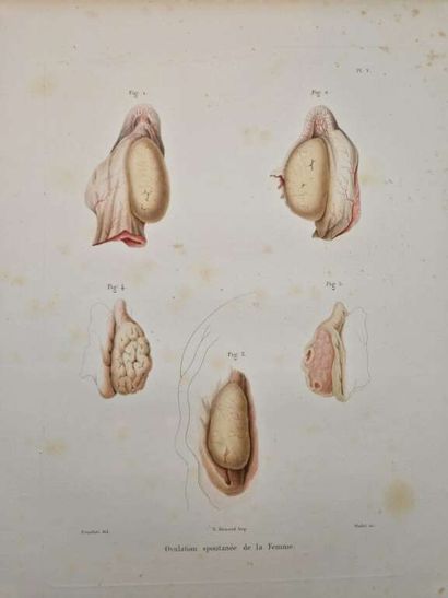 POUCHET, Félix Archimède. Théorie Positive...