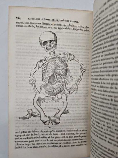 BOUCHUT, Eugène. Traité Pratique des Maladies...
