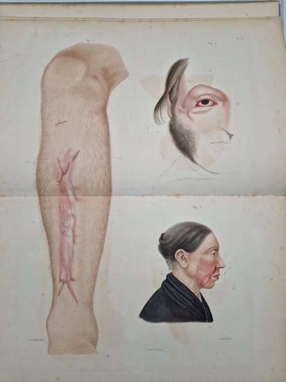JOBERT DE LAMBALLE, Antoine-Joseph. Traité...