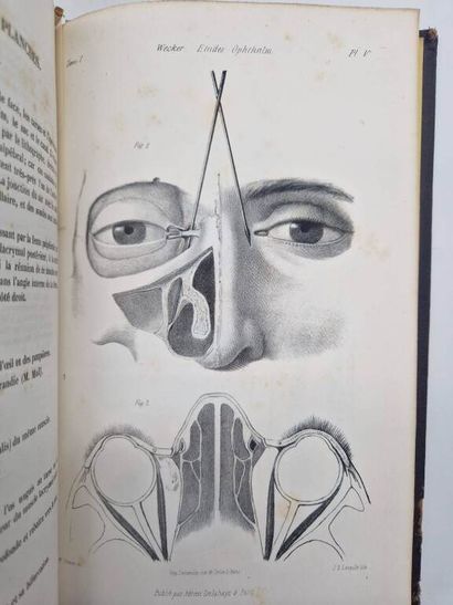 WECKER, Louis de. Traité Théorique et Pratique...