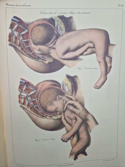 MOREAU, François-Joseph. Traité Pratique...