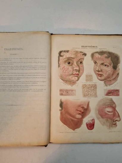 RAYER, Pierre. Traité des Maladies de la...