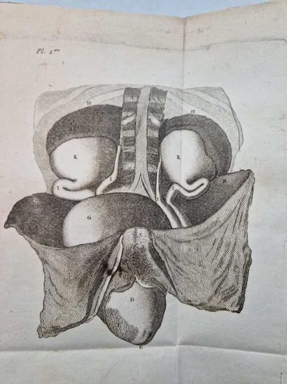 DESAULT, Pierre Joseph. Traité des Maladies...