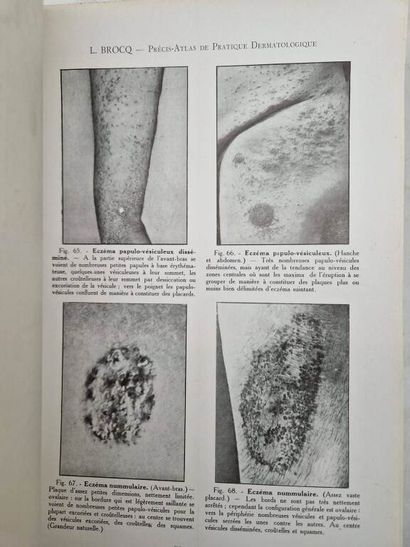 BROCQ, Louis. Précis-Atlas de Pratique Dermatologique....