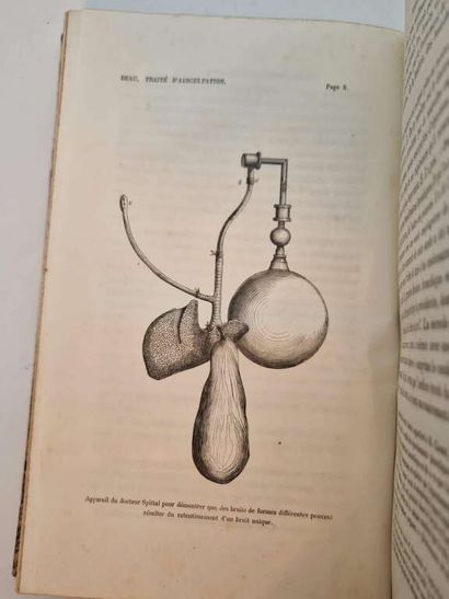 BEAU, Joseph Honoré Simon. Traité Expérimental...