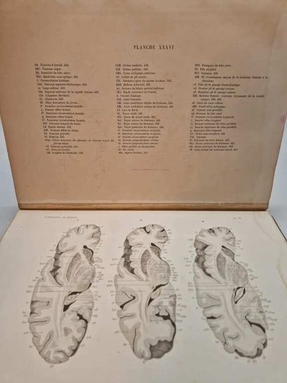 BRISSAUD, Edouard. Anatomie du Cerveau de...