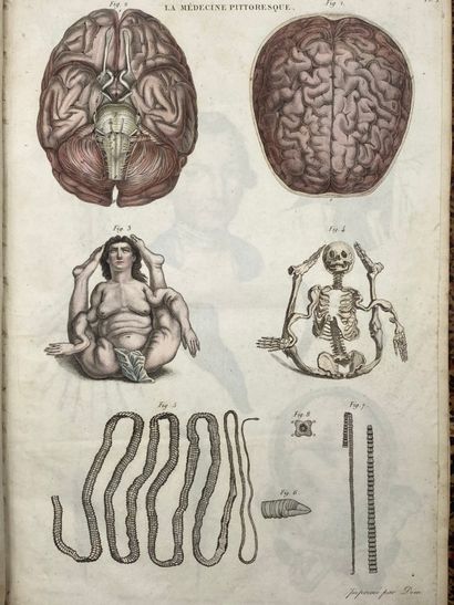 BAYLE, Antoine Laurent. La Médecine Pittoresque,...