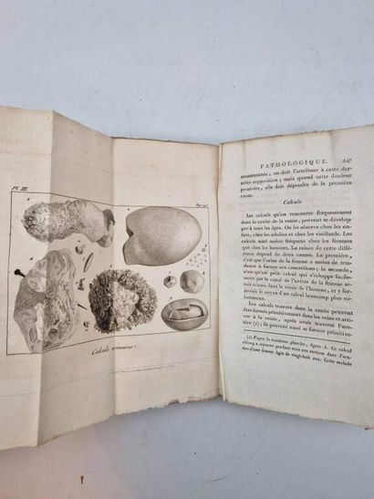 BAILLIE, Mathieu. Anatomie Pathologique des...
