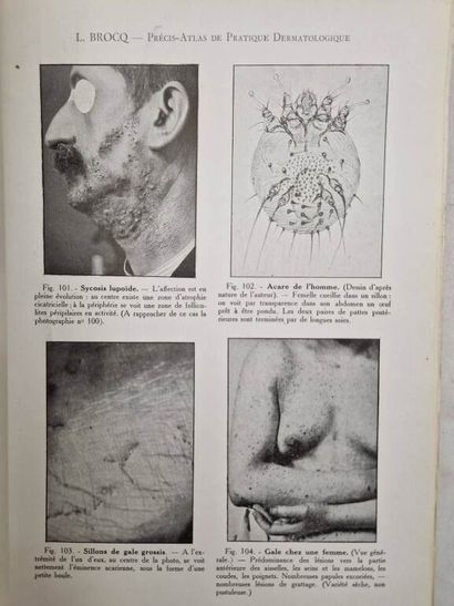 BROCQ, Louis. Précis-Atlas de Pratique Dermatologique....