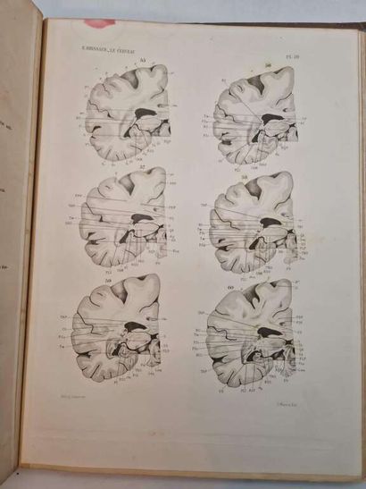 BRISSAUD, Edouard. Anatomie du Cerveau de...