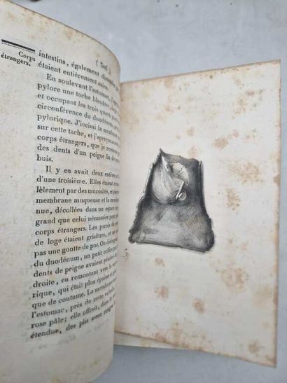JOURNAL Général de Médecine, Chirurgie, Pharmacie,...