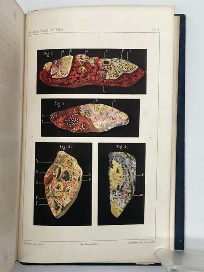 HERARD, Hippolyte Victor and CORNIL, Victor...