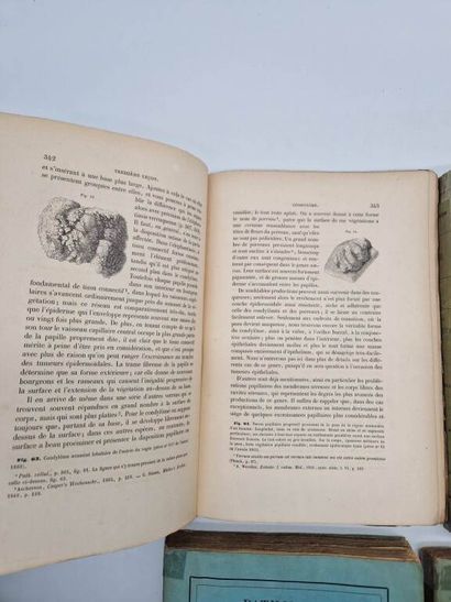 VIRCHOW, Rudolf Karl. Pathologie des Tumeurs....