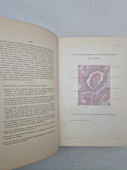 LETULLE, Maurice. Le Poumon. Published in...