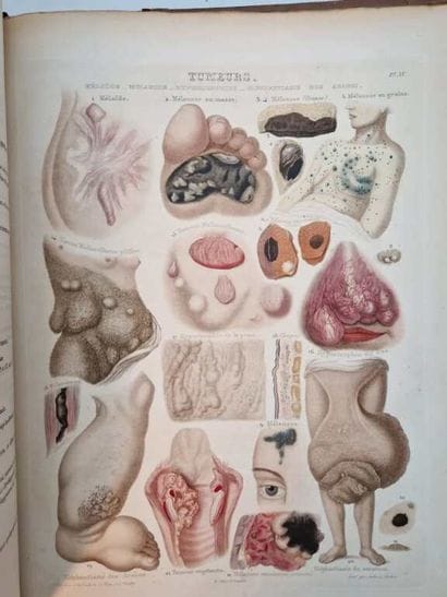 RAYER, Pierre. Traité des Maladies de la...