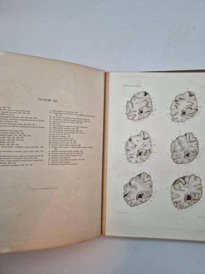 BRISSAUD, Edouard. Anatomie du Cerveau de...