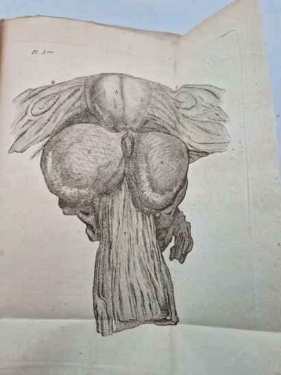 DESAULT, Pierre Joseph. Traité des Maladies...