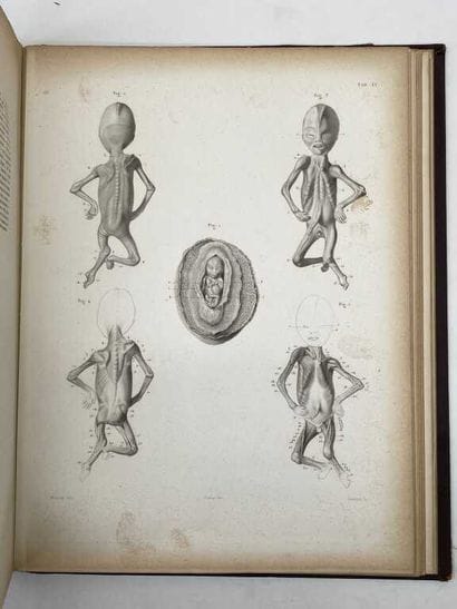 GUERIN, Jules. Atlas. Difformités congénitales...