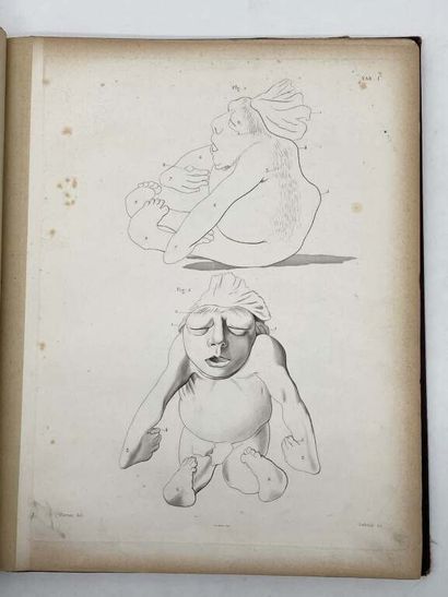 GUERIN, Jules. Atlas. Difformités congénitales...