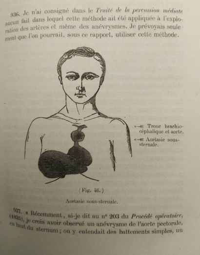 PIORRY, Pierre Adolphe. Traité de plessimétrisme...