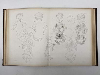 GUERIN, Jules. Atlas. Difformités congénitales...