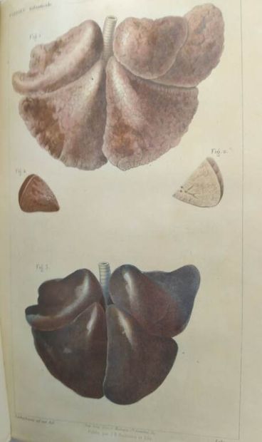 TARDIEU, Ambroise. Etude médico-légale sur...