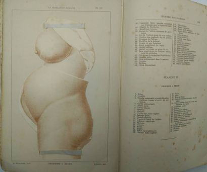 WITKOWSKI, Gustave-joseph. Set of 2 volumes...