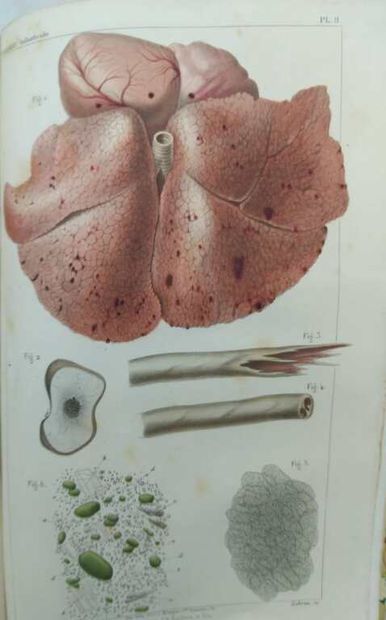 TARDIEU, Ambroise. Etude médico-légale sur...