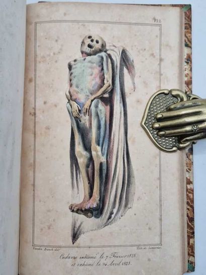 ORFILA, Mathieu. Leçons de Médecine Légale.
Paris,...