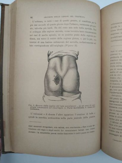 CHARCOT, Jean-Martin. Lezioni sulle malattie...