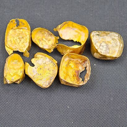 Dental gold, net weight: 12.1 g.